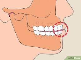 We did not find results for: How To Stop Clenching Jaw 14 Steps With Pictures Wikihow