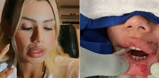 Vídeo: blogueira relata momentos de pânico ao ser atacada por cachorro em  casa alugada pelo Airbnb em Praia do Forte