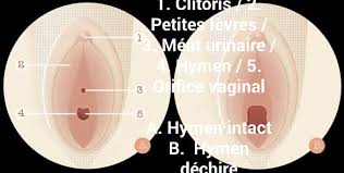 Si elle ne touche pas que la femme, l'infection urinaire est plus fréquente chez les femmes. Gynecologie Et Sexiologie Medicale Par Docteur Tresorking Posts Facebook
