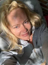 Detecting aura colors after self healing?