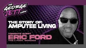 Eric Ford amputee living, accident left him without a leg. Support &  Healing