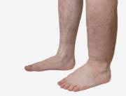 Check spelling or type a new query. Macam Macam Penyakit Endemik Di Indonesia Alodokter