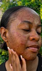 Bafaz sizan intwala ziqedwa ngani kwi nanaz