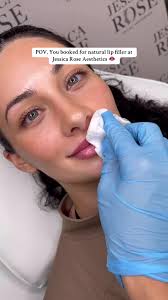 Enhance Your Lips with Natural Lip Filler at Jessica Rose Aesthetics