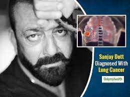 Breaking Sanjay Dutt Diagnosed With Lung Cancer Taking Break For Treatment