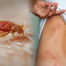 Hire a trusted local pest control company in spring, tx. Top One Pest Control Home Facebook