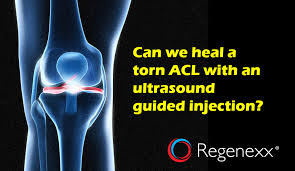 Cant Inject Acl Ultrasound Ligament Tear Ultrasound Knee Surgery