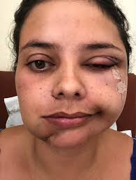 Estilista luta para voltar a sorrir após paralisia facial e conta  experiência em blog: 'sonho todos os dias que estou sorrindo'