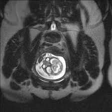 fetal mr goruntuleme yararli bilgiler guney emar