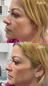 Jessica Marcano modelando en el 7mo BellaFashion. Fue una experiencia  mágica, Belladonna Medical Wellness le otorga una pasarela a sus pacientes  que han logrado cambiar su vida controlando su peso. Superaron muchos