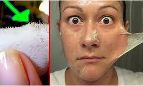 Astuce Une Recette Miracle Pour Les Points Noirs Point Noir Recette Beaute Coiffure Et Beaute