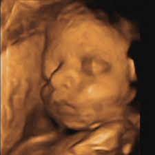 3d 4d Ultrasound Frauenarzt Stuttgart