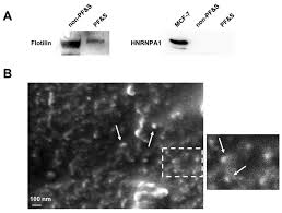 Mauricio bertullo comision fiscal dr. Cells Free Full Text Older Adults With Physical Frailty And Sarcopenia Show Increased Levels Of Circulating Small Extracellular Vesicles With A Specific Mitochondrial Signature Html