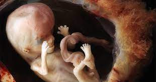 Ramai di antara ibubapa kurang mengambil perhatian terhadap pusat bayi kita yang baru lahir. 7 Tanda Janin Tidak Berkembang Apakah Tanda Keguguran Popmama Com