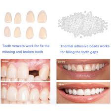 At up to $2,500 for a single tooth, dental veneers are a serious investment in your smile. Amazon Com Temporary Tooth Repair Kit Teeth Veneers For Fix The Missing Tooth Teaching Thermal Fitting Beads For Filling The Broken Tooth And Teeth Gap Resin Fake Teeth Crown Beauty