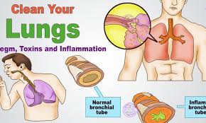 How To Get Rid Of Phlegm And Mucus In Chest Getting Rid Of Phlegm Mucus Persistent Cough