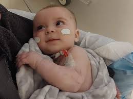 Fundraiser by Brooke Long : Baby Jensens medical needs