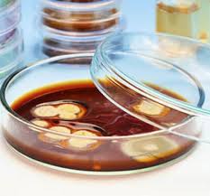 Image result for Stool Culture