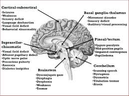 Second, to leukemia, a pediatric brain tumor is the most common form of malignancy in children. Neurodiagnostic Principles Neupsy Key