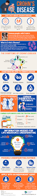 Life Insurance With Lupus Lupus Symptoms Risk Factors Common Treatments Life Insurance With Lupus And Life Insurance Policy Life Insurance Lupus Symptoms
