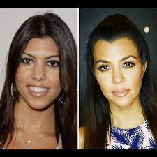 Wiederholt als die dickste der kardashians betitelt begann khloé schließlich, an besagten kurven zu feilen, ging regelmäßig ins fitnessstudio und präsentierte ihren. Die Kardashians Damals Und Heute