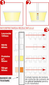 Dimpotrivă, dacă urina seamănă cu mierea închisă la culoare, sunt șanse mari să se fi instalat o stare de deshidratare, așadar copilul ar trebui să. Test Infectie Urinara Veneris Lugulugu
