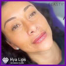 HyaLips