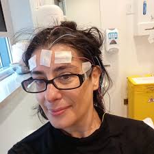 E.E.G. #epilepsy #dance #involuntarydances #invisibledisability  @artsanddisabilityireland