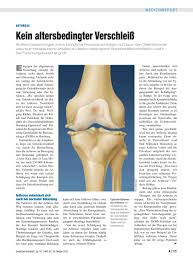 Bei arthrose handelt es sich um einen verschleiß des gelenkknorpels, wobei alle gelenke des menschlichen körpers betroffen sein können. Arthrose Kein Altersbedingter Verschleiss