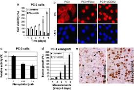 When prostate cancer spreads, it&#x27;s common for cancer cells to. Aberrant Nucleocytoplasmic Localization Of The Retinoblastoma Tumor Suppressor Protein In Human Cancer Correlates With Moderate Poor Tumor Differentiation Oncogene