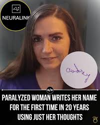 She wrote her name… using just her thoughts.🧠 Audrey Crews, a quadriplegic  since age 16, just made history with a brain chip from Neuralink. Using a  coin-sized implant connected to her motor