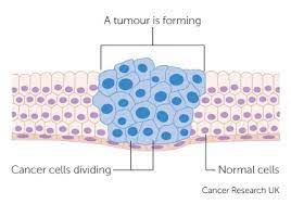 A 3d animation about the formation and introduction of cancer cells in our skin and into our blood stream as caused by uv rays.subscribe to st. Cancer Cells Cancer Research Uk