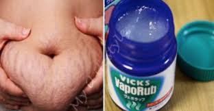 How To Use Vicks Vaporub To Get Rid Of Accumulated Belly Fat And Cellulite Eliminate Stretch Marks And Have Firmer Skin I M Just Sayin
