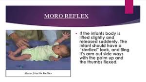 Control Of Posture & Postural Reflexes - Medatrio