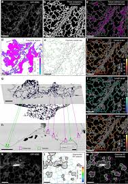 The name endoplasmic reticulum has two parts. Quantitative Analysis Of Plant Er Architecture And Dynamics Nature Communications