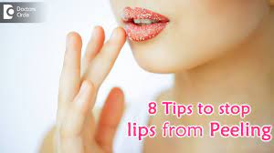5 Ways To Heal Constant Peeling Of Lip Skin|Remedy By  Dermatologist-Dr.rasya Dixit | Doctors' Circle - Youtube