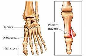 Maybe you would like to learn more about one of these? Sakit Kaki Bagian Atas Punggung Kaki Dapat Disebabkan Oleh 4 Hal Ini