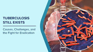 Image result for Tuberculosis