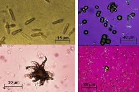 Various Forms Of Ammonium Hydrogen Urate Crystals Download Scientific Diagram