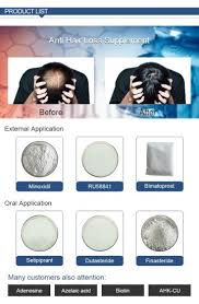 I suppose the study that was completed 12/31/09 for. Anti Hair Loss Treatment Supplement Powder Hair Care Products Improve Hair Regrowth Growth China Hair Loss Treatment Hair Treatment Made In China Com