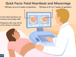 Risk Of Miscarriage With Slow Fetal Heartbeat