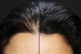 Good for short and medium length hair, this pomade works well on fine, curly, straight and thick hair types. The Best Styling Products For Thinning Hair Male Standard