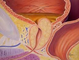 Trigger Point Injection Effective For Pelvic Floor Spasm In Men Clinical Pain Advisor