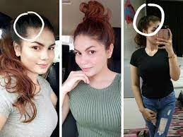 Cara terbaik untuk menggunakan teh hijau untuk rambut adalah dengan menyediakan bilas rambut. Ini 3 Bahan Yang Dia Guna Hingga Berjaya Lebatkan Semula Rambut Kurangkan Gugur Maskulin