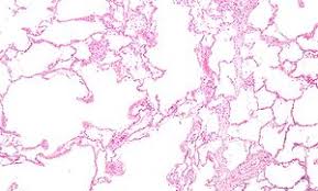 Lubricating the layers in the space in between. Respiratory Disease Wikipedia