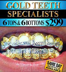 We make the gold teeth and gold teeth with diamonds. We Re Shining All 2019 Visit The Gold Teeth Specialist Facebook
