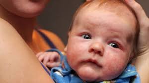 La vitamine k est essentielle pour produire des protéines capables de réguler la coagulation sanguine. A Quoi Sert La Vitamine K Chez Le Nourrisson Femme Actuelle Le Mag