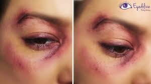 I Got Punched Bruised Black Eye Makeup Tutorial By Eyedolizemakeup Black Eye Makeup Eye Makeup Tutorial Bruises Makeup