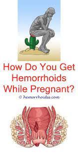 Pin On Internal Hemorrhoids