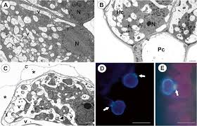 Image result for Genlisea subglabra